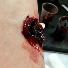 Bullet exit wound